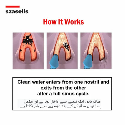 Nose Cleaning Bottle – Smooth Breathing & Comfort Care